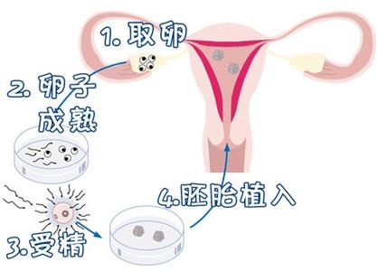 关于三代试管生男孩